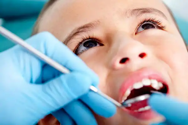 فلورایدتراپی دندان کودکان چیست ؟