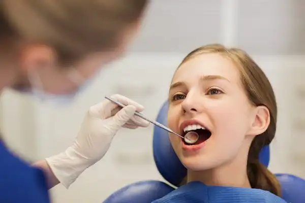 فیشورسیلانت دندان کودکان چیست ؟